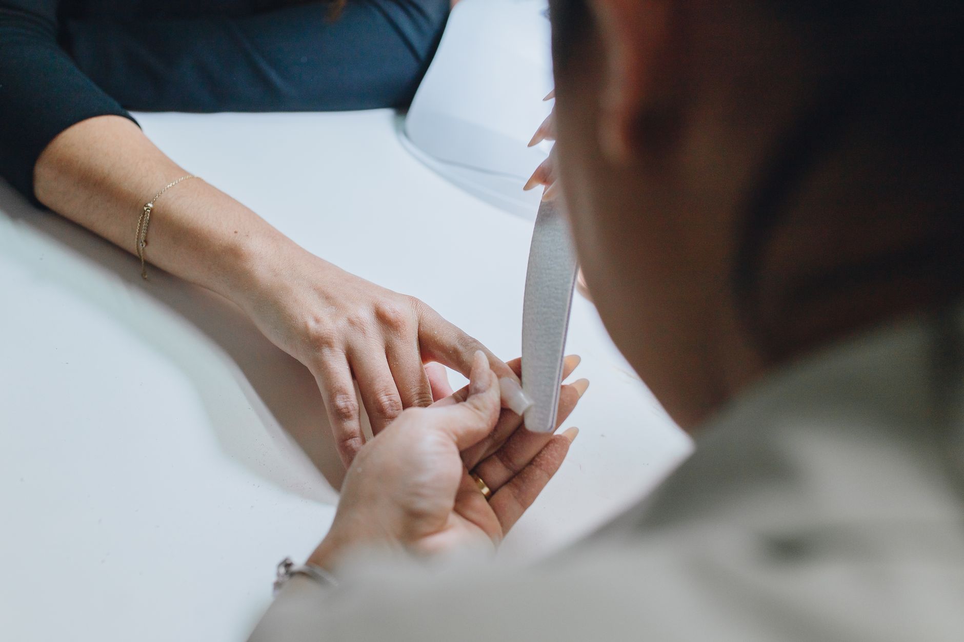 #10 — Vertical Nail Ridges From Intermittent Fasting