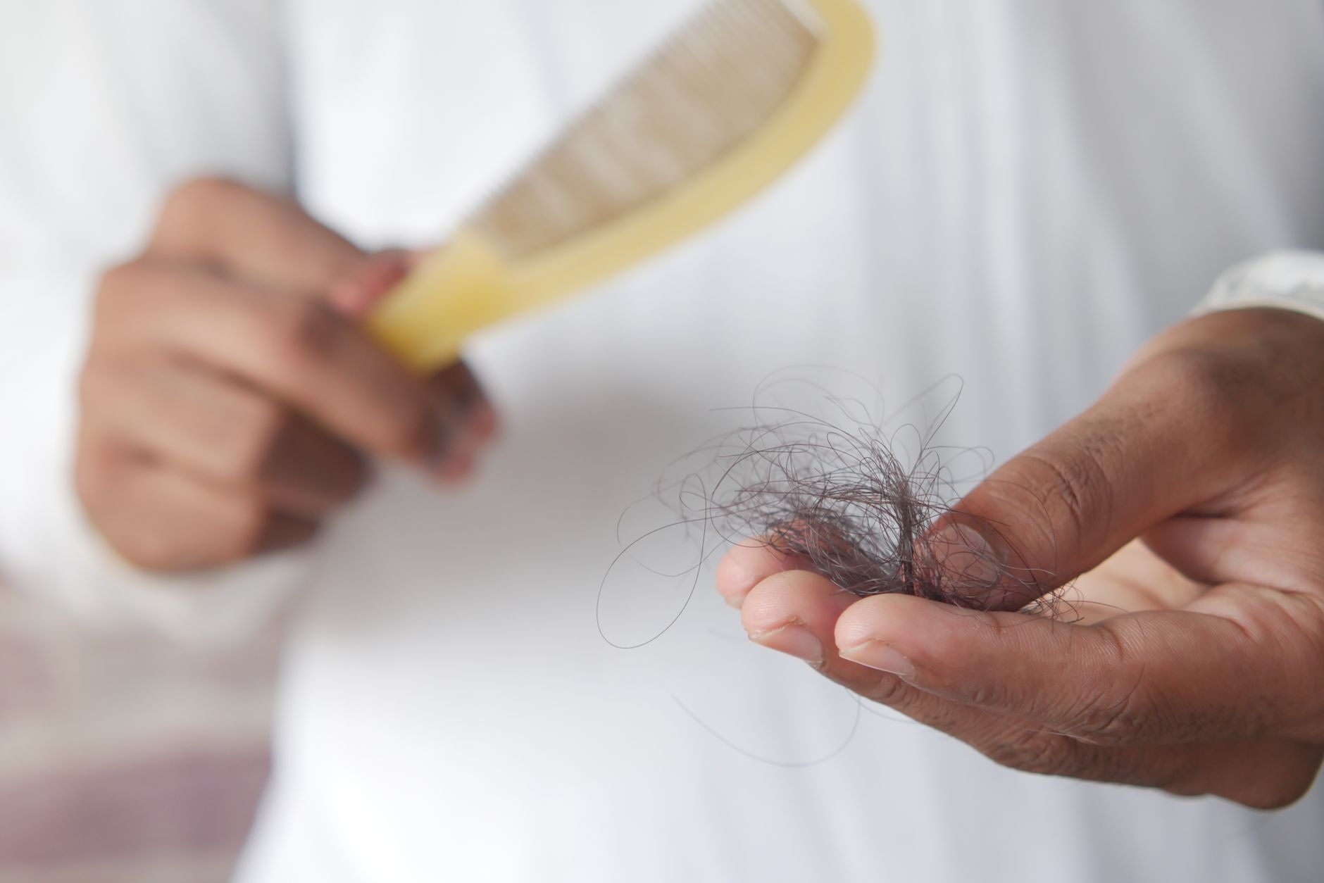 #12 — Scalp Flaking Within Weeks of Going Vegan
