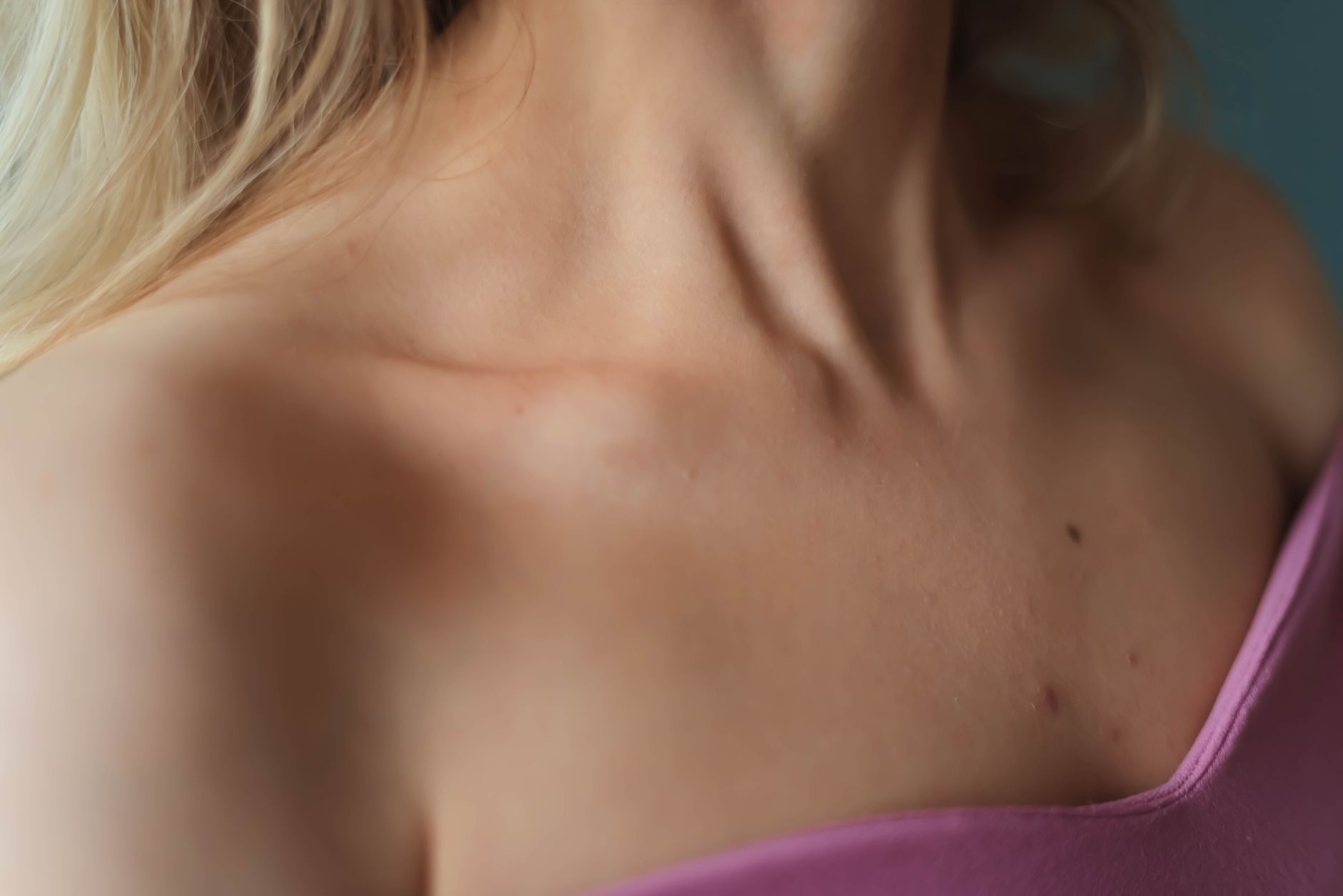 #3 — Rough, Bumpy Upper Arms From Low Vitamin A